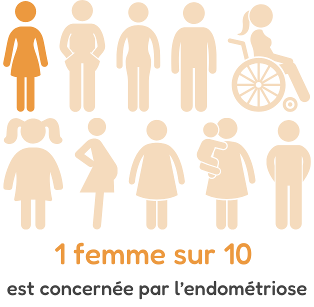 1 femme sur 10 est concernée par l'endométriose