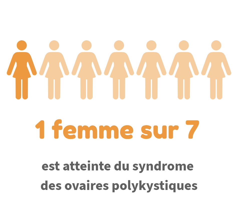 1 femme sur 7 est atteinte du syndrome des ovaires polykystiques