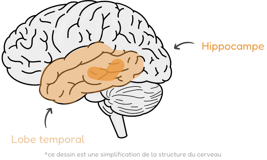 schéma du cerveau représentant le lobe temporal et l'hippocampe