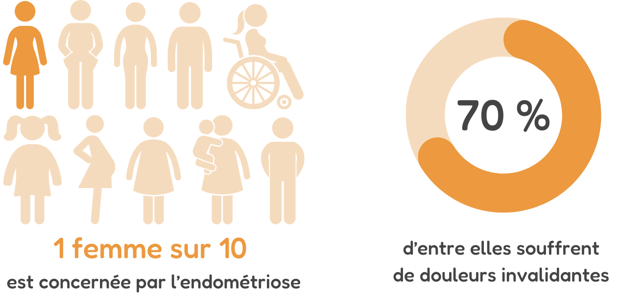 1 femme sur 10 est concernée par l'endométriose, 79 % d'entre elles souffrent de douleurs invalidantes